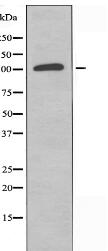 USP15 Antibody