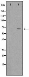 SLC22A5 Antibody