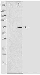 SLC9A6 Antibody