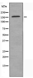 SMRC2 Antibody
