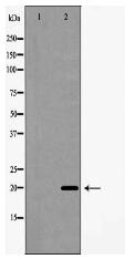 Interleukin 20 Antibody