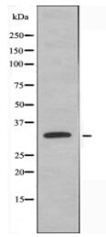 Mlx Antibody
