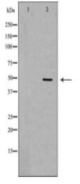 LTBR Antibody