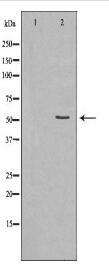 SLC16A4 Antibody
