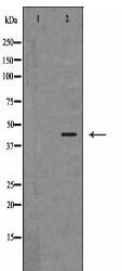SERPINB5 Antibody