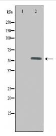 UEVLD Antibody
