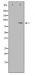 ITGB2 Antibody