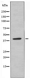 PRPF18 Antibody