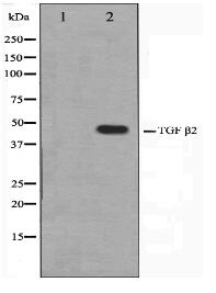 TGF beta2 Antibody