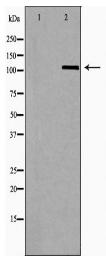OGT Antibody