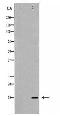 Interleukin 5 Antibody