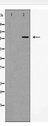 Integrin α5 (CD49e) Antibody