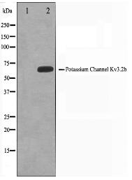 KCNC2 Antibody