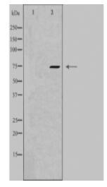 MYST2 Antibody