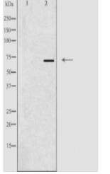 NCOA4 Antibody