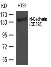 N-Cadherin Antibody