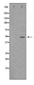 SERPINA11 Antibody