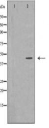 NDRG1 Antibody