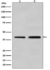 alpha smooth muscle Actin Antibody