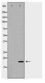 VAMP2 Antibody