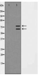 Ku70/80 Antibody