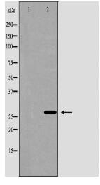 SMNDC1 Antibody