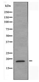 NCBP2 Antibody