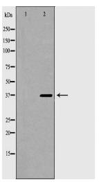 TOR1A Antibody