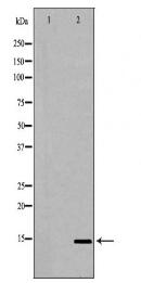 UTS2 Antibody
