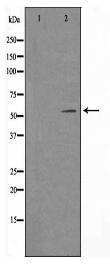 TSEN54 Antibody