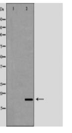 LCN6 Antibody