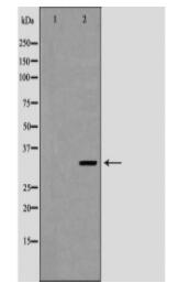 NAT1 Antibody