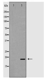 VIP Antibody