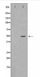 SERPINA3 Antibody