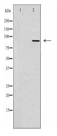 TLK2 Antibody