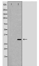 IL1B Antibody