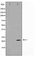 TPD54 Antibody