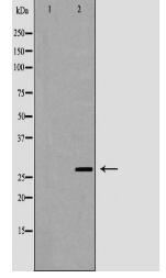 SFTPA1 Antibody
