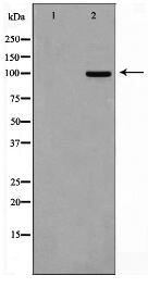 M-CSF Receptor Antibody