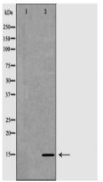 NDP Antibody