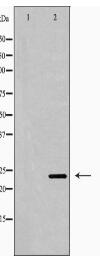 IL-6 Antibody