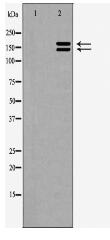 TSC1 Antibody