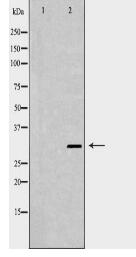 XPA Antibody