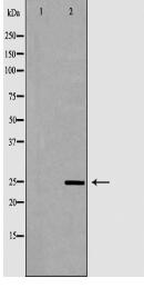 SOD2 Antibody