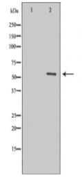 MYOC Antibody