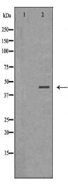 SSTR1 Antibody