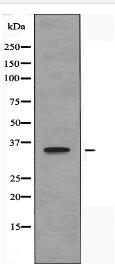 TAS2R13 Antibody