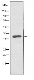 KCNK4 Antibody