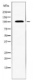 SLC4A11 Antibody