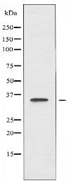 SLC25A21 Antibody